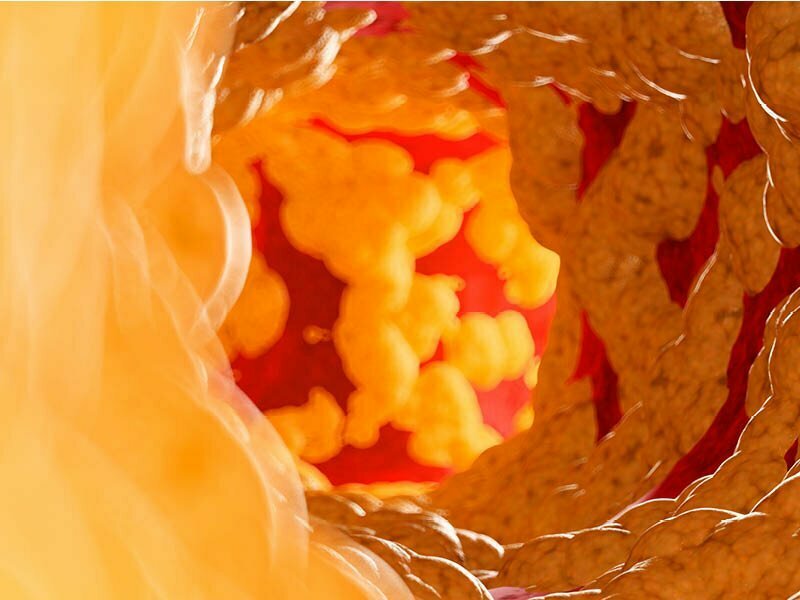 Photo of The ldl cholesterol problem: a manual to the first-rate meals to improve the ones numbers