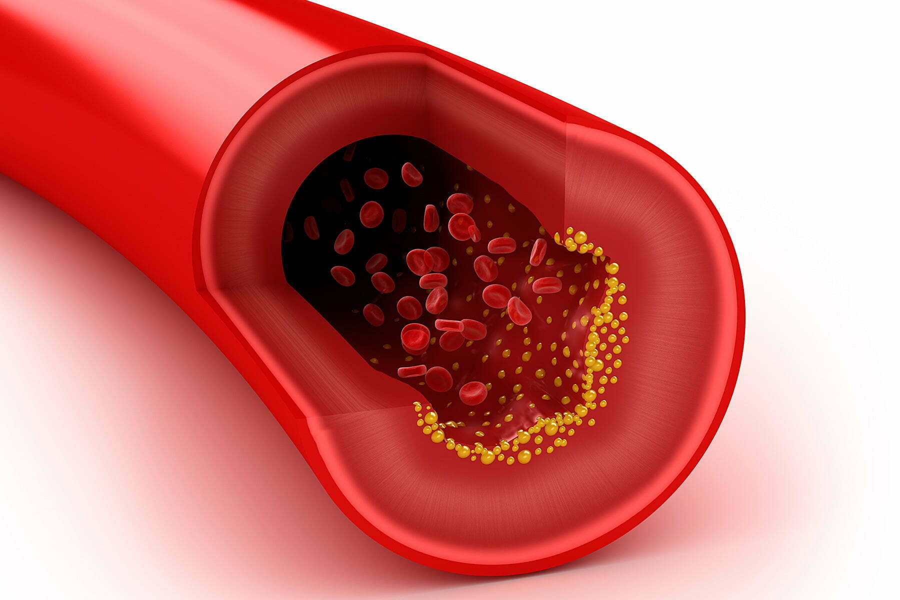 Photo of What is ldl cholesterol and what are the advocated levels?