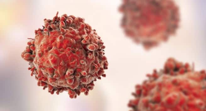Photo of Why People of Different Ages Need Different Cancer Treatments