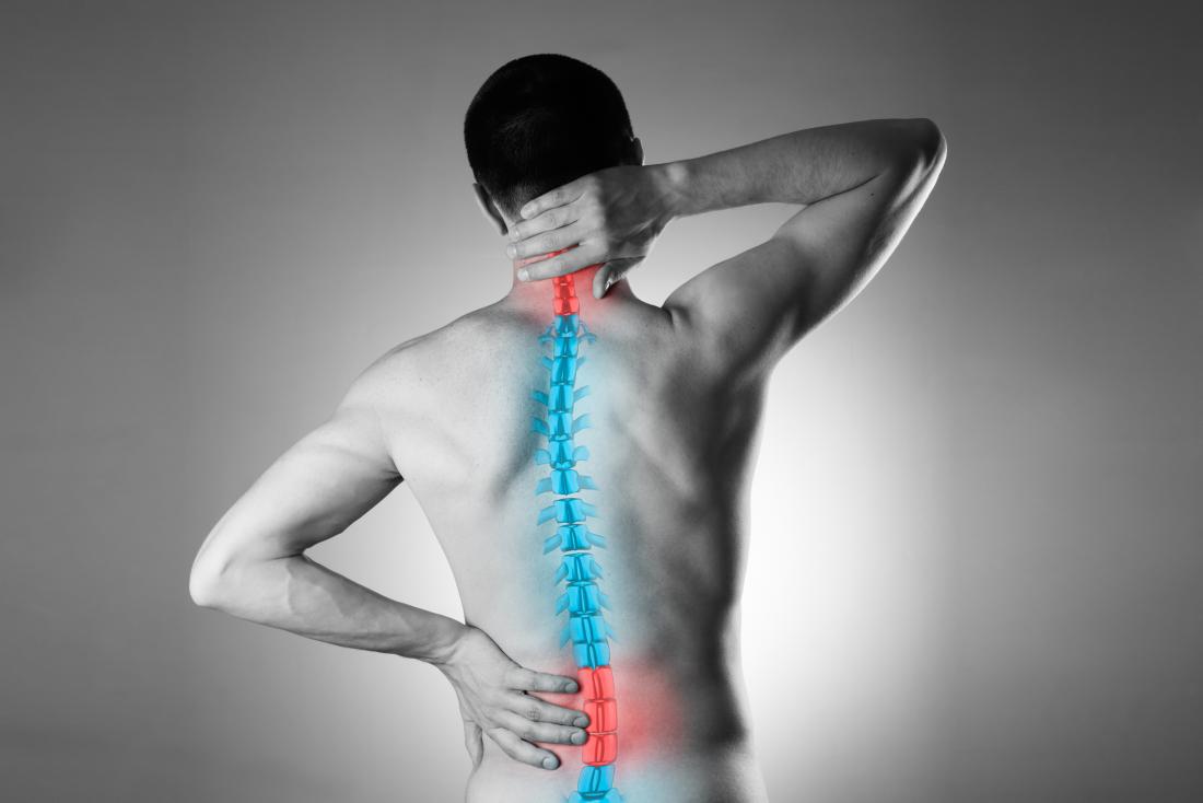 Photo of Kelsey-Seybold Clinic physicians: Back ache impacts 90% of these age 30 and older, cause of melancholy and tension for lots