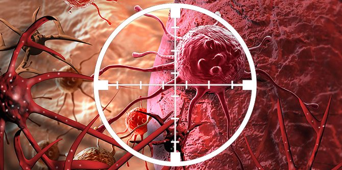 Photo of Walking speed predicts clinical outcomes in older adults with blood cancers