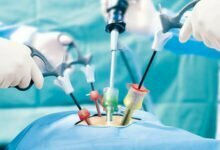 Photo of Back ache: From reasons and remedy to minimally invasive surgical procedure, what you want to recognise