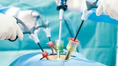 Photo of Back ache: From reasons and remedy to minimally invasive surgical procedure, what you want to recognise