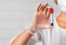 Photo of Amid current COVID-19 concerns, STDs continue to rise to unprecedented levels