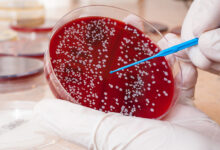 Photo of How to Treat Blood Cancer in 2022