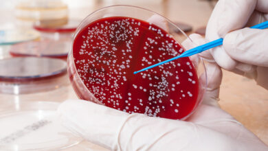 Photo of How to Treat Blood Cancer in 2022