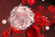Photo of How to Cure Blood Cancer Without Chemotherapy?