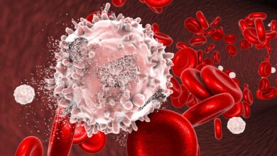 Photo of How to Cure Blood Cancer Without Chemotherapy?