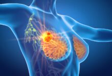 Photo of 7 Proven Breast Cancer Symptoms You Have No Idea About