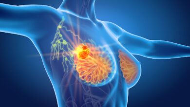 Photo of 7 Proven Breast Cancer Symptoms You Have No Idea About