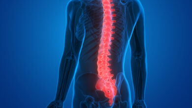 Photo of Spinal Cord Injury Treatment and Rehabilitation in the United States