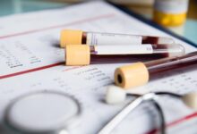 Photo of High Basophil Cancer: The Most Common Form of Leukemia