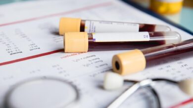Photo of High Basophil Cancer: The Most Common Form of Leukemia