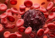 Photo of Older Patients With Blood Cancer Should Discuss Daily Function With Their Health Care Team