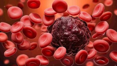 Photo of Older Patients With Blood Cancer Should Discuss Daily Function With Their Health Care Team