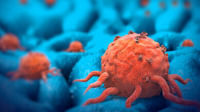 Photo of Some Colorectal Cancers Are “Born To Be Bad,” Have Already Spread Long Before Diagnosis