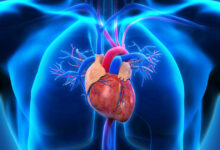 Photo of Coronary heart disease might also accelerate cognitive decline