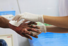 Photo of Sandoval fortunate to avoid serious hand damage