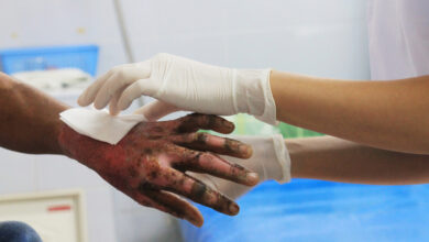 Photo of Sandoval fortunate to avoid serious hand damage