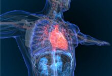 Photo of To lower coronary heart disorder danger, switch beef for beans