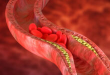 Photo of Healthy blood vessels may additionally postpone cognitive decline, study suggests