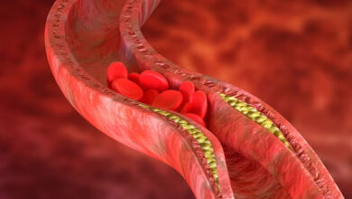 Photo of Healthy blood vessels may additionally postpone cognitive decline, study suggests