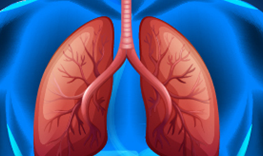 Photo of Managing Multifocal Pneumonia: Treatment and Prevention