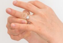 Photo of How to Remove a Ring from a Swollen Finger