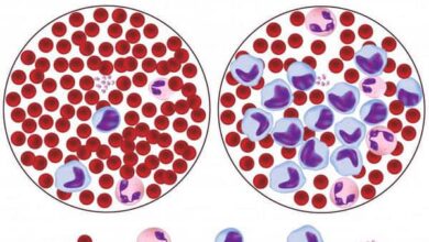 Photo of Understanding Normal MPV Range in Blood
